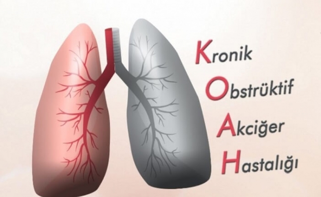 KOAH hakkında bilinmesi gereken beş önemli nokta